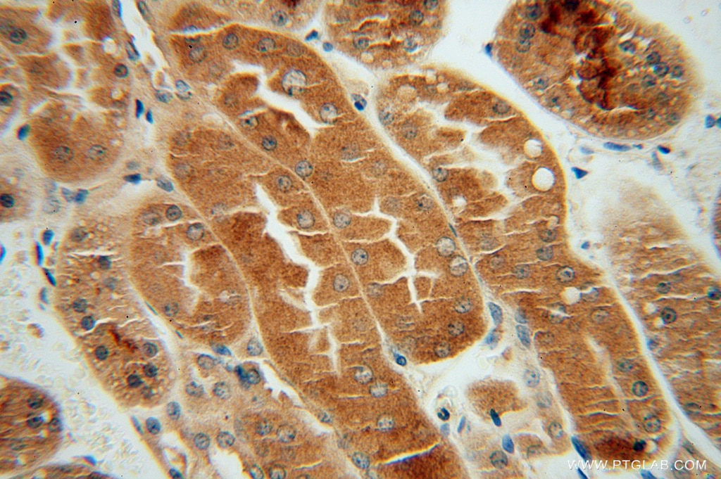 Immunohistochemistry (IHC) staining of human kidney tissue using CHMP7 Polyclonal antibody (16424-1-AP)