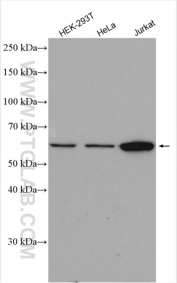 Western Blot (WB) analysis of various lysates using CHMP7 Polyclonal antibody (16424-1-AP)
