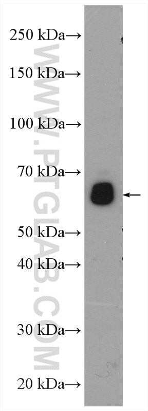 Western Blot (WB) analysis of mouse spinal cord tissue using CHMP7 Polyclonal antibody (16424-1-AP)
