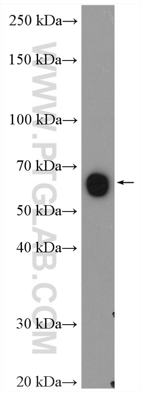 Western Blot (WB) analysis of rat spinal cord tissue using CHMP7 Polyclonal antibody (16424-1-AP)