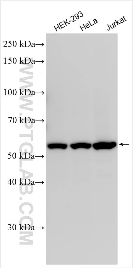 Western Blot (WB) analysis of various lysates using CHMP7 Polyclonal antibody (16424-1-AP)