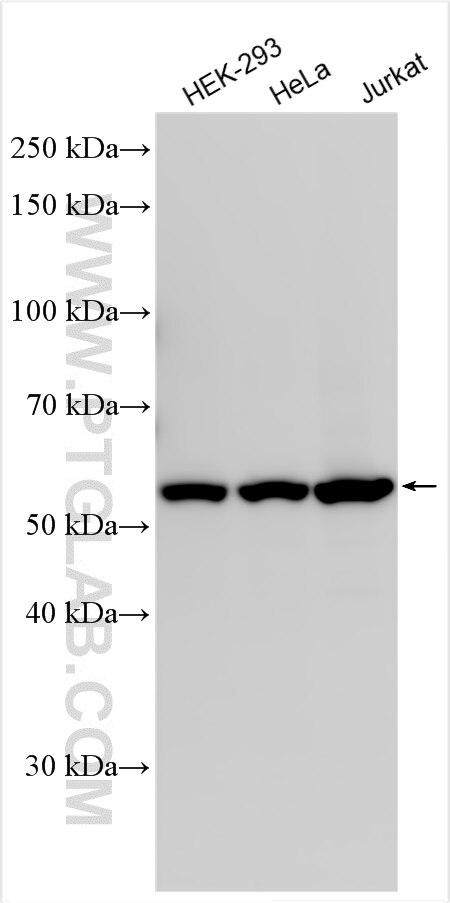 Western Blot (WB) analysis of various lysates using CHMP7 Polyclonal antibody (16424-1-AP)