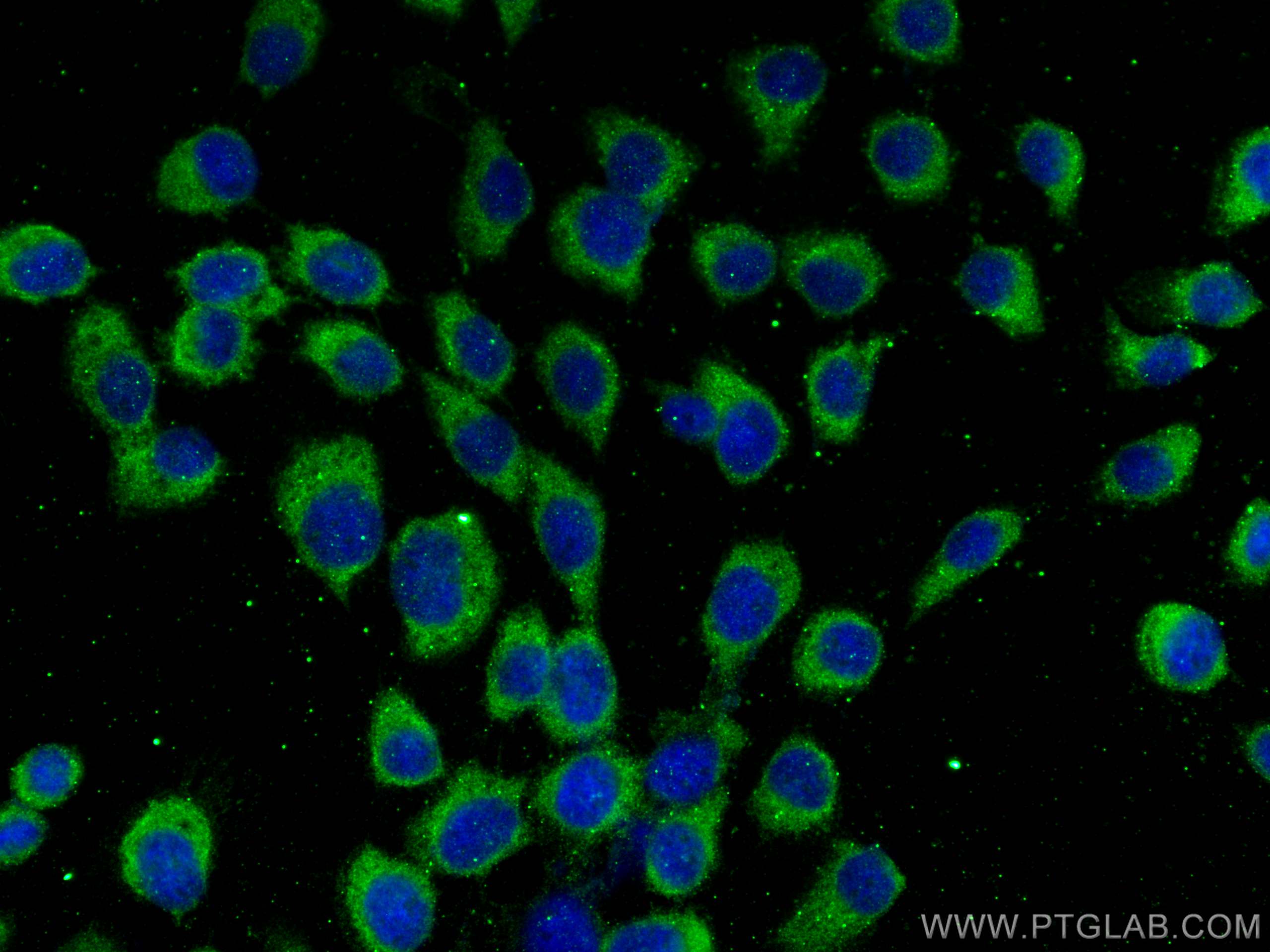 Immunofluorescence (IF) / fluorescent staining of A431 cells using CHMP7 Monoclonal antibody (68406-1-Ig)