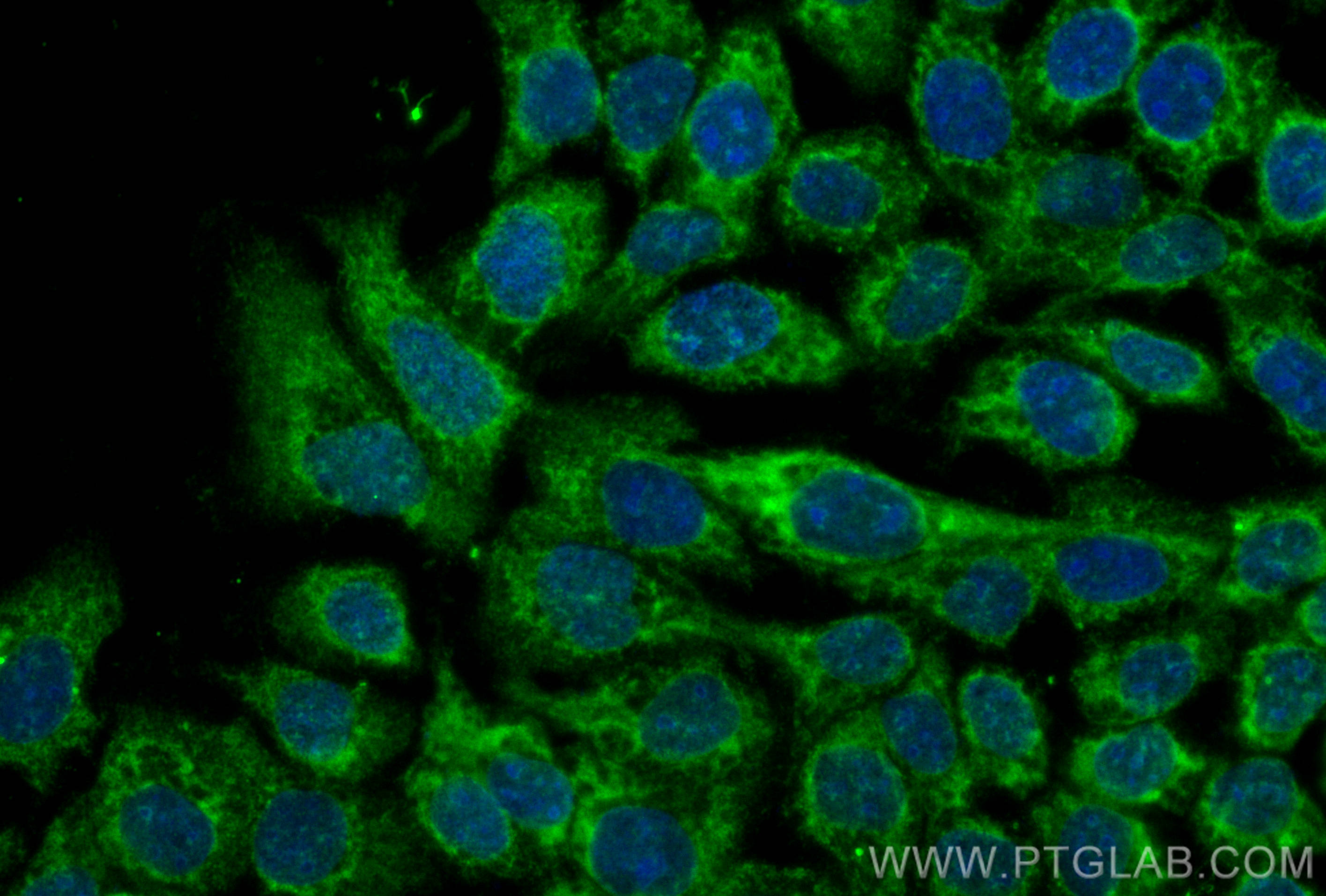 Immunofluorescence (IF) / fluorescent staining of A431 cells using CoraLite® Plus 488-conjugated CHMP7 Monoclonal ant (CL488-68406)