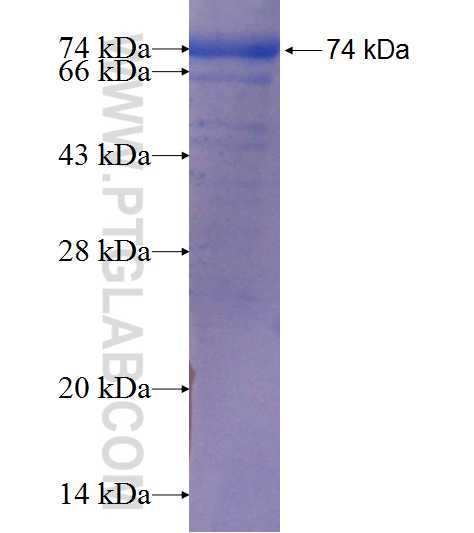 CHMP7 fusion protein Ag9625 SDS-PAGE