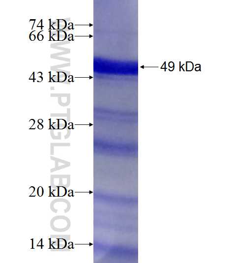 CHMP7 fusion protein Ag9641 SDS-PAGE