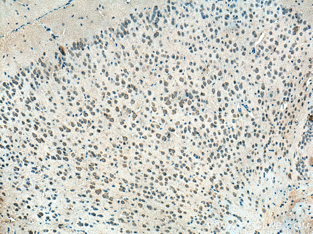 Immunohistochemistry (IHC) staining of mouse brain tissue using CHN1 Polyclonal antibody (12048-1-AP)