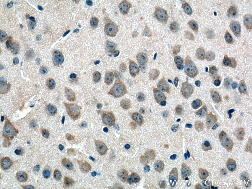 Immunohistochemistry (IHC) staining of mouse brain tissue using CHN1 Polyclonal antibody (12048-1-AP)