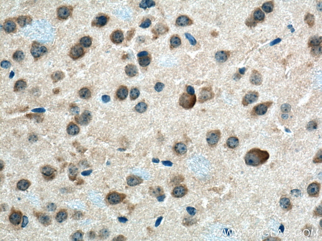 Immunohistochemistry (IHC) staining of mouse brain tissue using CHN1 Polyclonal antibody (12048-1-AP)