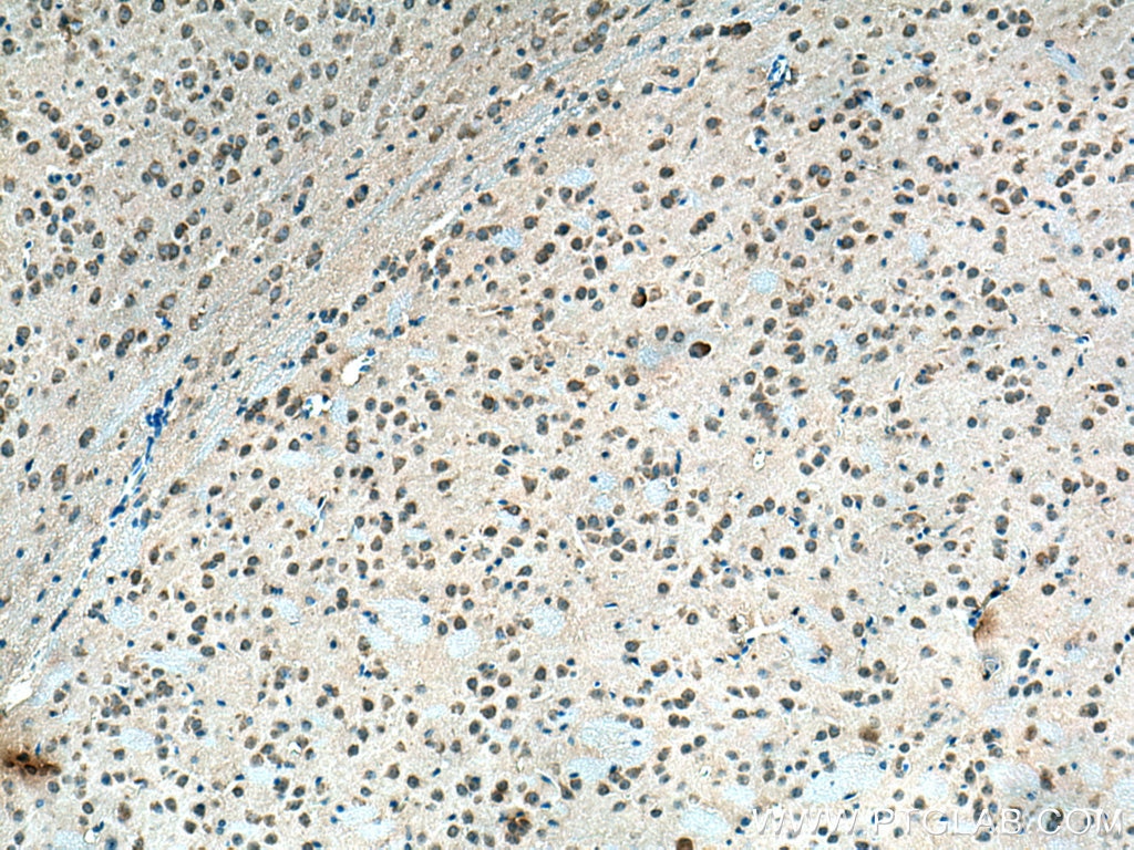 Immunohistochemistry (IHC) staining of mouse brain tissue using CHN1 Polyclonal antibody (12048-1-AP)