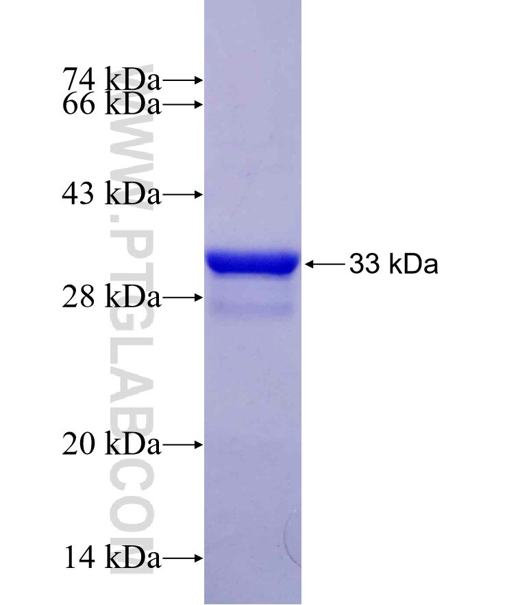 CHN1 fusion protein Ag29721 SDS-PAGE