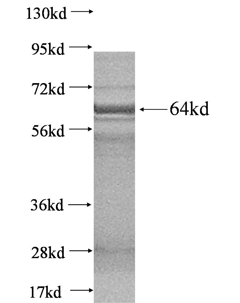 CHN1 fusion protein Ag2678 SDS-PAGE