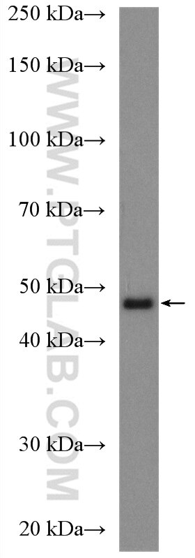 Western Blot (WB) analysis of fetal human brain tissue using Chimaerin 2 Polyclonal antibody (18259-1-AP)