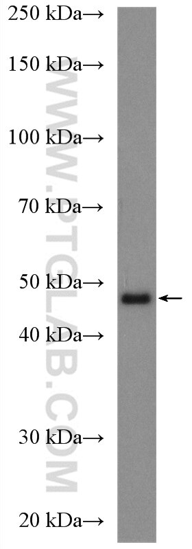 Western Blot (WB) analysis of fetal human brain tissue using Chimaerin 2 Polyclonal antibody (18259-1-AP)