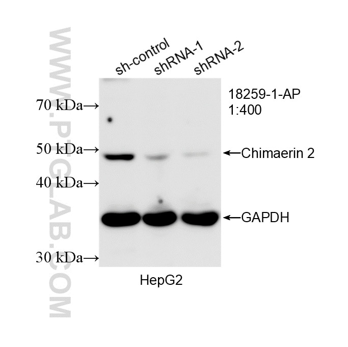 Western Blot (WB) analysis of HepG2 cells using Chimaerin 2 Polyclonal antibody (18259-1-AP)