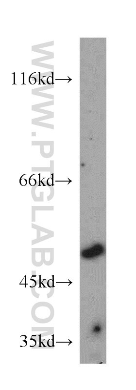 Western Blot (WB) analysis of mouse cerebellum tissue using Chimaerin 2 Polyclonal antibody (18259-1-AP)