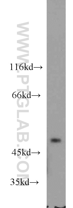 Western Blot (WB) analysis of mouse cerebellum tissue using Chimaerin 2 Polyclonal antibody (18259-1-AP)
