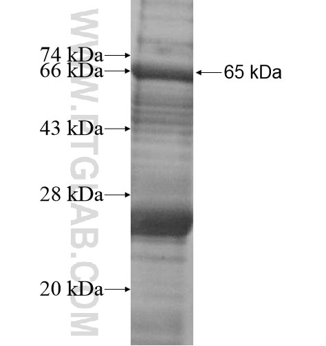 CHN2 fusion protein Ag13106 SDS-PAGE