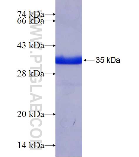 CHOP; GADD153 fusion protein Ag7522 SDS-PAGE