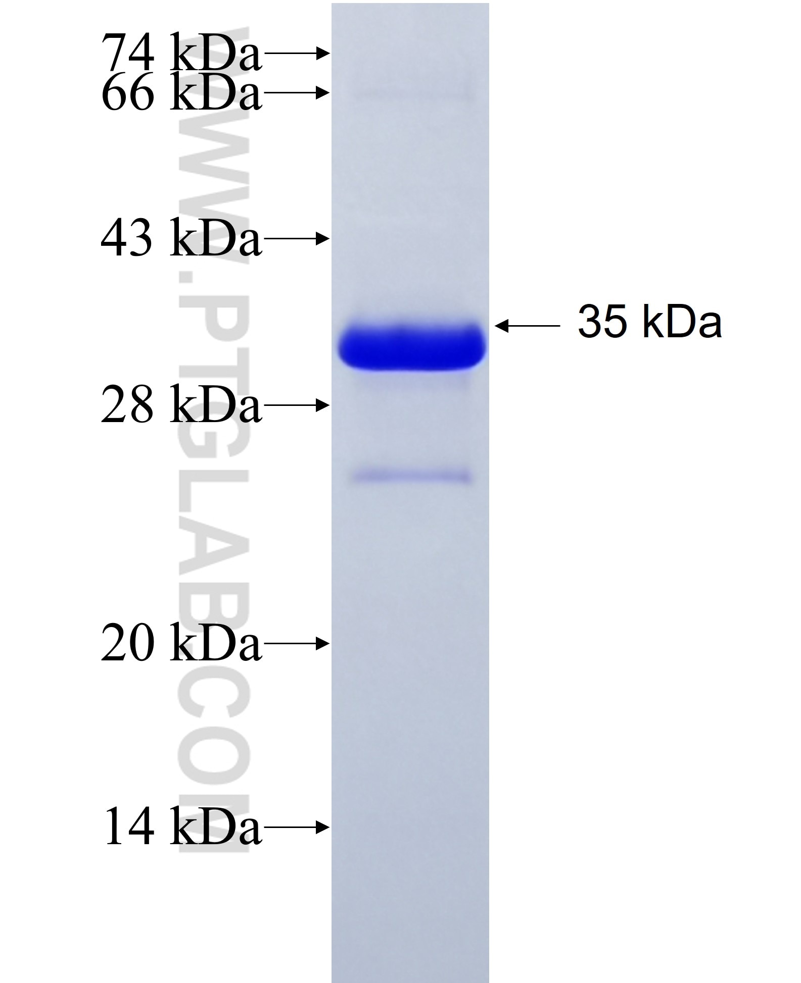 CHOP; GADD153 fusion protein Ag7522 SDS-PAGE