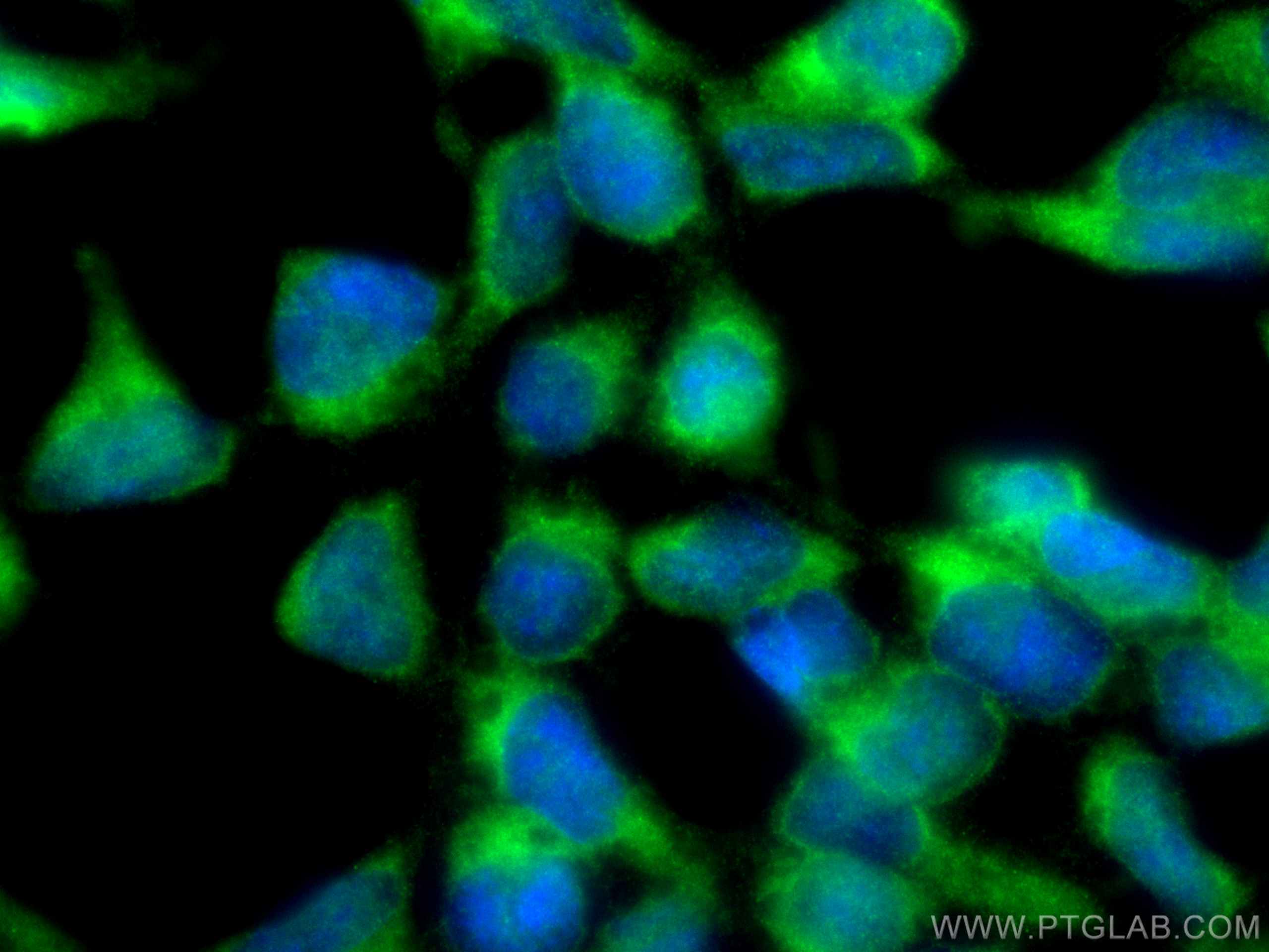 Immunofluorescence (IF) / fluorescent staining of HEK-293 cells using CHORDC1 Polyclonal antibody (25525-1-AP)