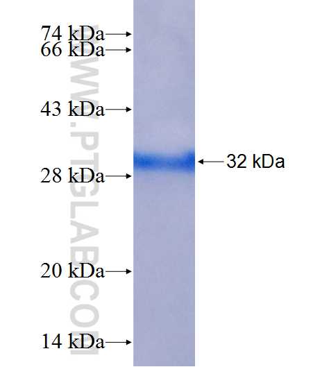 CHP fusion protein Ag25360 SDS-PAGE