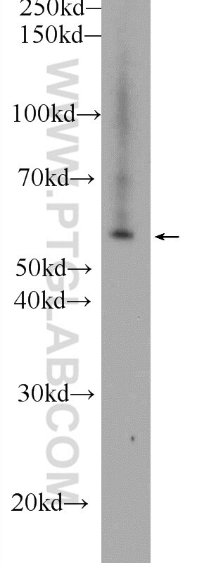 Western Blot (WB) analysis of HEK-293 cells using CHPF C-terminal Polyclonal antibody (11524-1-AP)