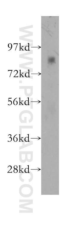 Western Blot (WB) analysis of human skeletal muscle tissue using CHPF C-terminal Polyclonal antibody (11524-1-AP)