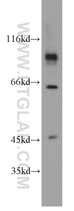 Western Blot (WB) analysis of human brain tissue using CHPF-N terminal Polyclonal antibody (15801-1-AP)