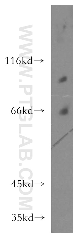 Western Blot (WB) analysis of human brain tissue using CHPF-N terminal Polyclonal antibody (15801-1-AP)