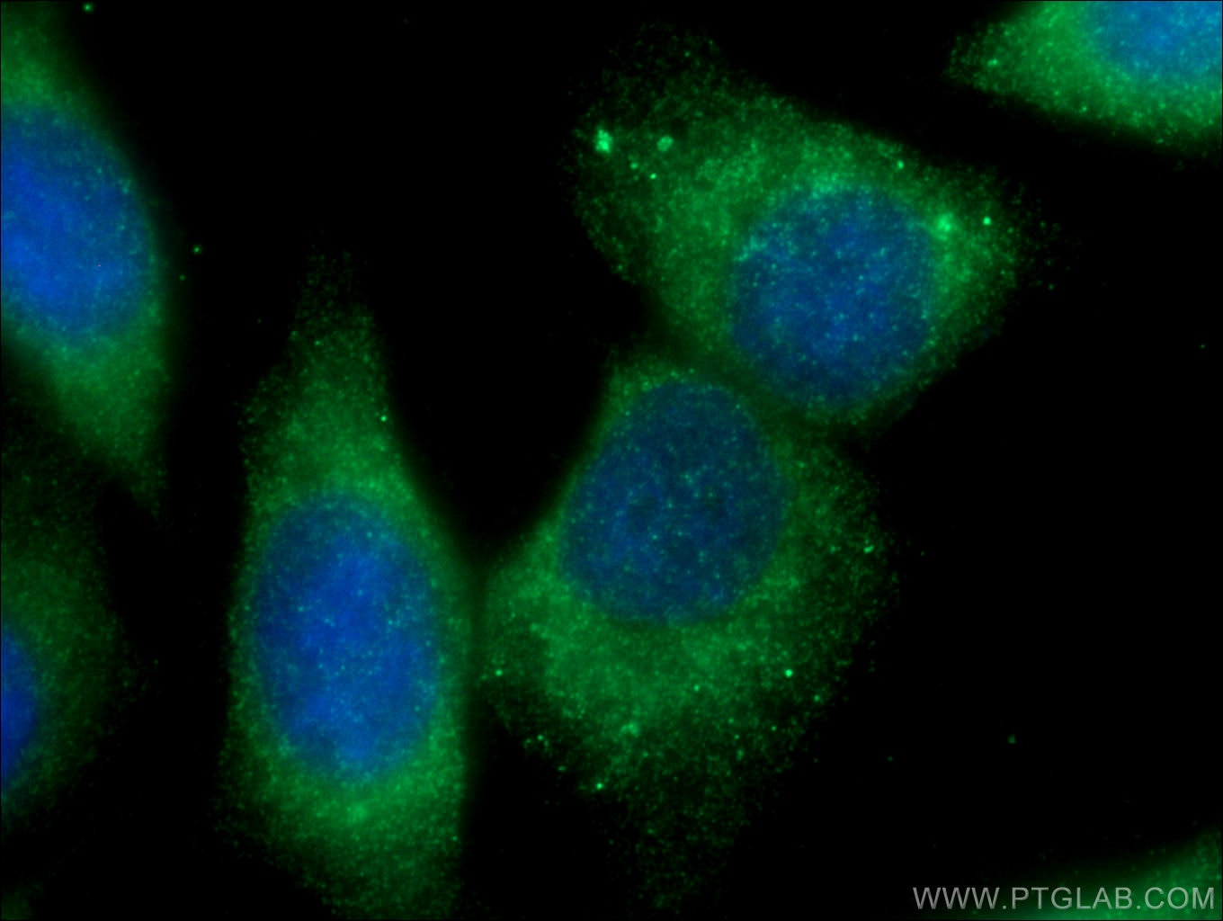 Immunofluorescence (IF) / fluorescent staining of HepG2 cells using CHPF N-terminal Polyclonal antibody (23953-1-AP)