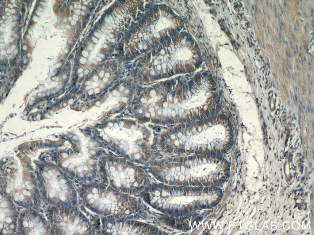 Immunohistochemistry (IHC) staining of human colon tissue using CHPF N-terminal Polyclonal antibody (23953-1-AP)