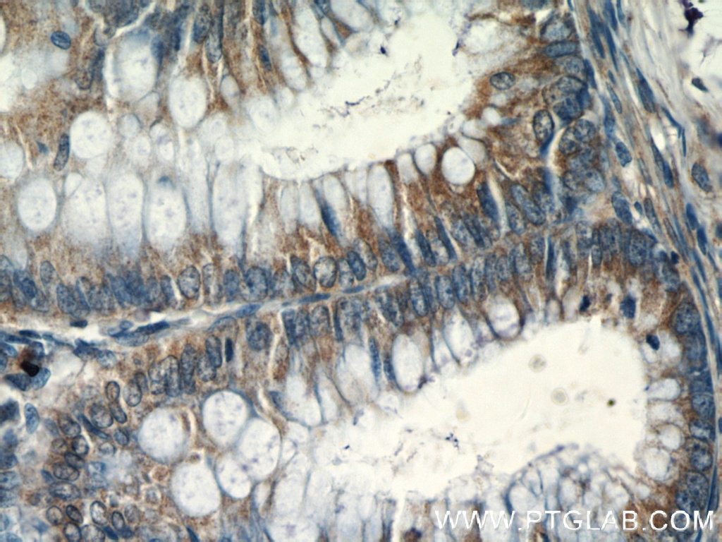 Immunohistochemistry (IHC) staining of human colon tissue using CHPF N-terminal Polyclonal antibody (23953-1-AP)