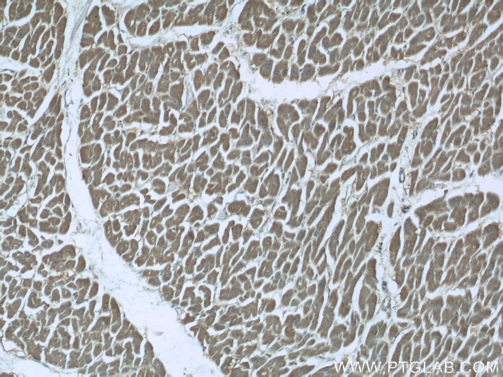 Immunohistochemistry (IHC) staining of human heart tissue using CHPF N-terminal Polyclonal antibody (23953-1-AP)