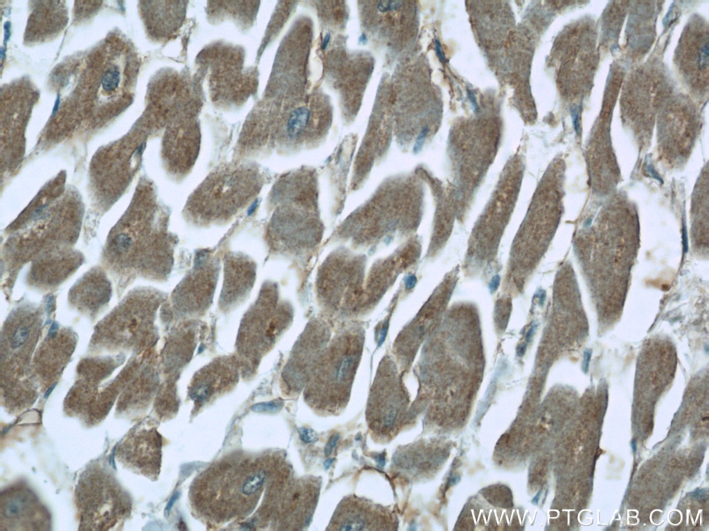 Immunohistochemistry (IHC) staining of human heart tissue using CHPF N-terminal Polyclonal antibody (23953-1-AP)