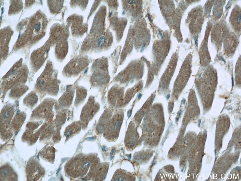 IHC staining of human heart using 23953-1-AP