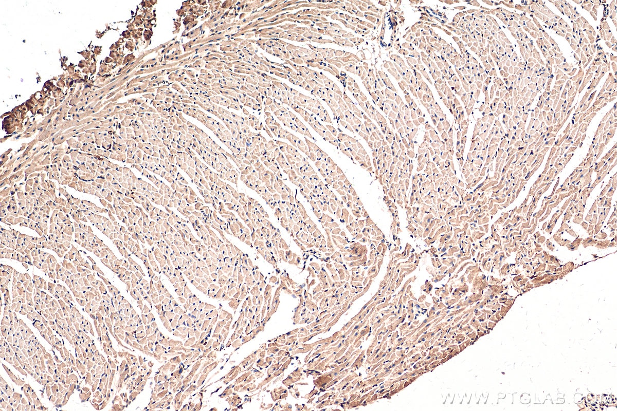 Immunohistochemistry (IHC) staining of mouse heart tissue using CHPF N-terminal Polyclonal antibody (23953-1-AP)