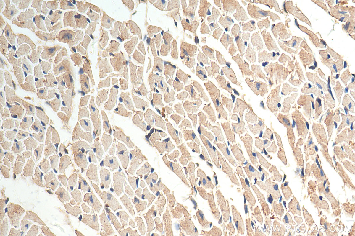 Immunohistochemistry (IHC) staining of mouse heart tissue using CHPF N-terminal Polyclonal antibody (23953-1-AP)