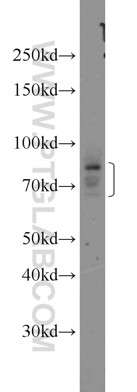 Western Blot (WB) analysis of C6 cells using CHPF N-terminal Polyclonal antibody (23953-1-AP)