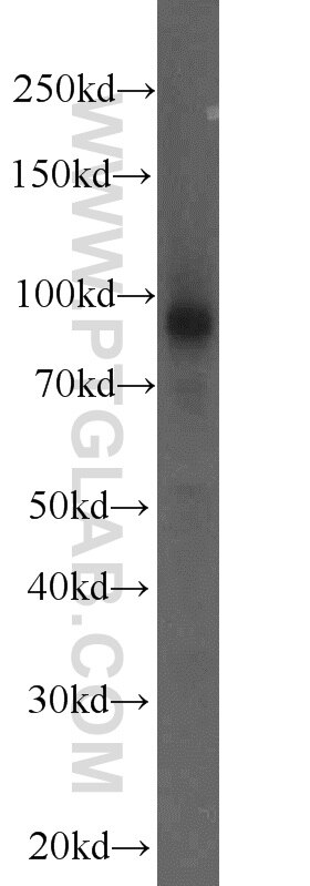 Western Blot (WB) analysis of human placenta tissue using CHPF N-terminal Polyclonal antibody (23953-1-AP)