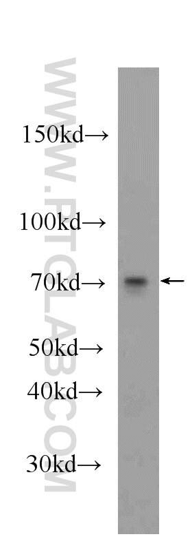 Western Blot (WB) analysis of mouse skeletal muscle tissue using CHPF N-terminal Polyclonal antibody (23953-1-AP)