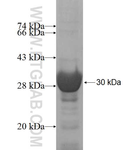 CHPT1 fusion protein Ag9797 SDS-PAGE