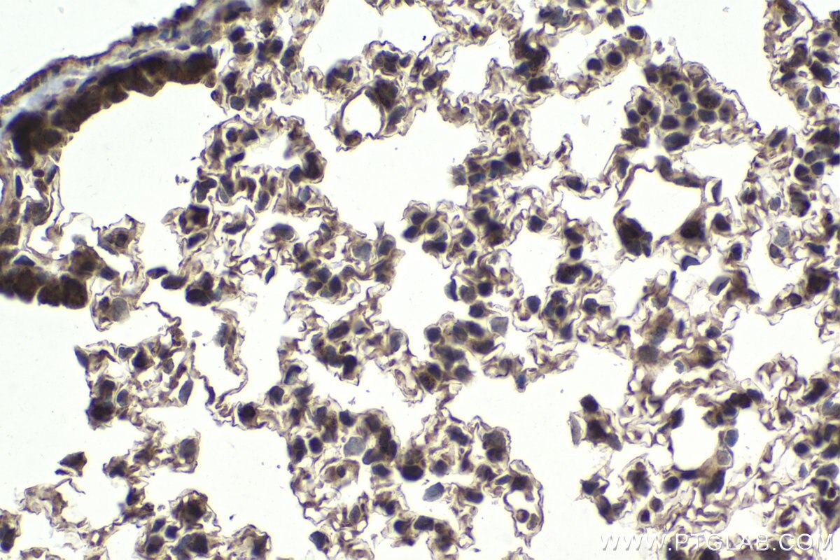Immunohistochemistry (IHC) staining of mouse lung tissue using CHRAC1 Polyclonal antibody (12126-2-AP)