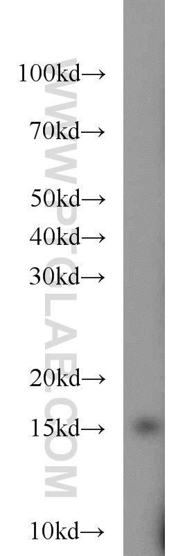 WB analysis of L02 using 12126-2-AP