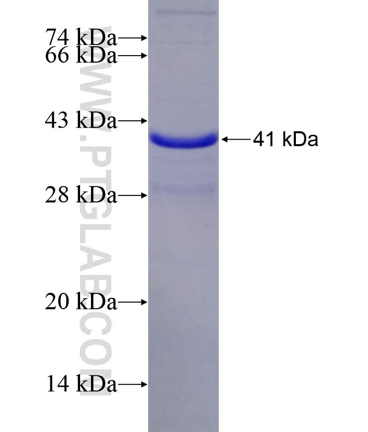 CHRAC1 fusion protein Ag2770 SDS-PAGE