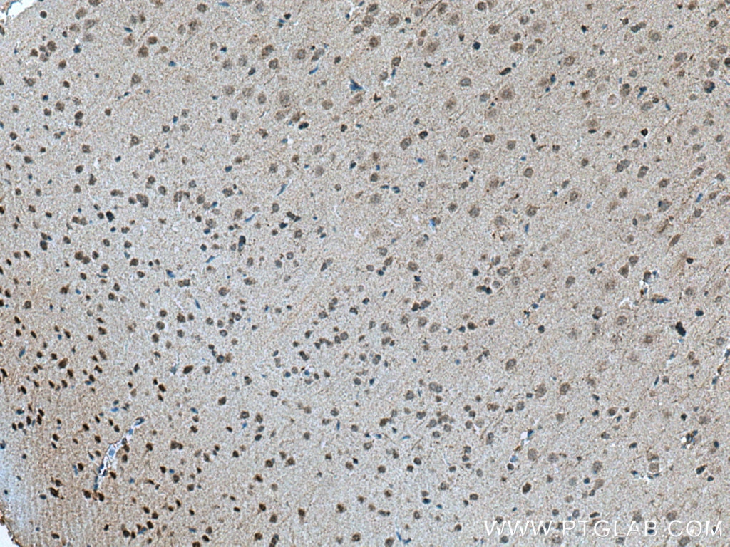 Immunohistochemistry (IHC) staining of rat brain tissue using Chordin Polyclonal antibody (27293-1-AP)