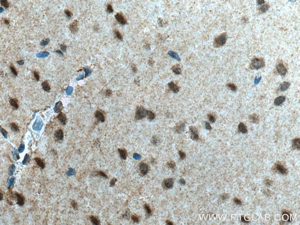 IHC staining of rat brain using 27293-1-AP