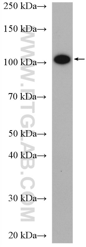 Western Blot (WB) analysis of 3T3-L1 cells using Chordin Polyclonal antibody (27293-1-AP)