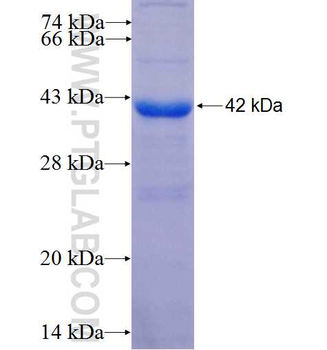 CHRD fusion protein Ag26010 SDS-PAGE