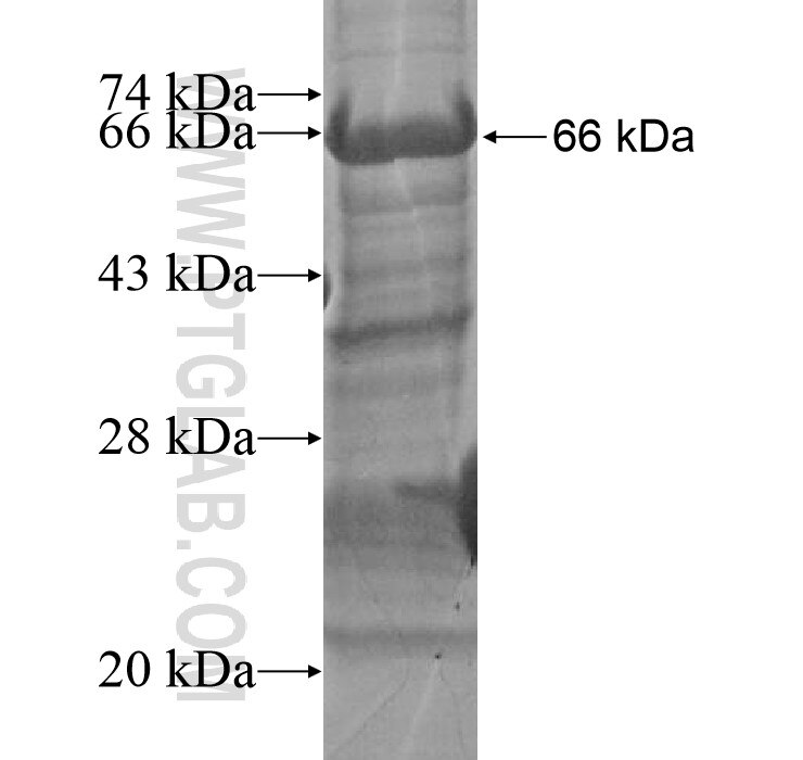 CHRDL2 fusion protein Ag15757 SDS-PAGE